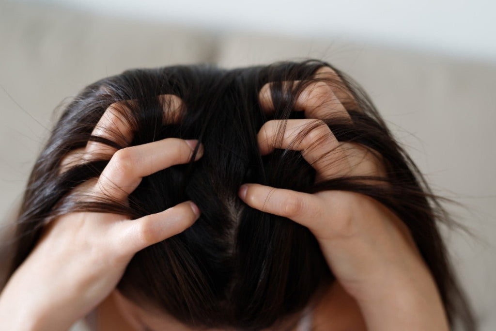 Combat Dandruff Across Different Hair Types - Hairdressing Supplies