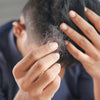 Understanding and Managing Hair Loss: Your Ultimate Guide - Hairdressing Supplies